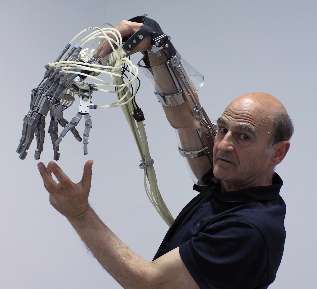 robotics prosthetics improvement body functions performance control physical